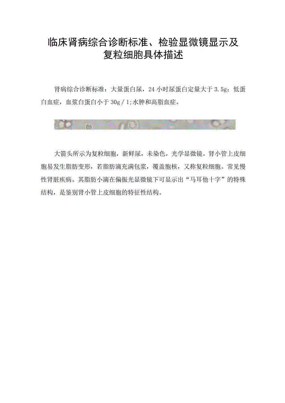 临床肾病综合诊断标准检验显微镜显示及复粒细胞具体描述.docx_第1页