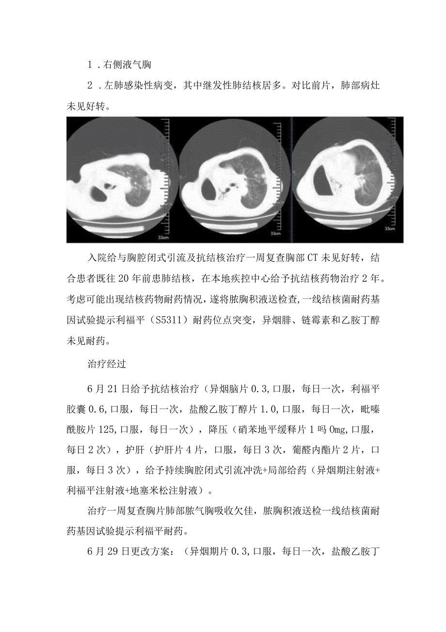 临床耐多药结核病疾病分享及发病机制及治疗措施.docx_第3页