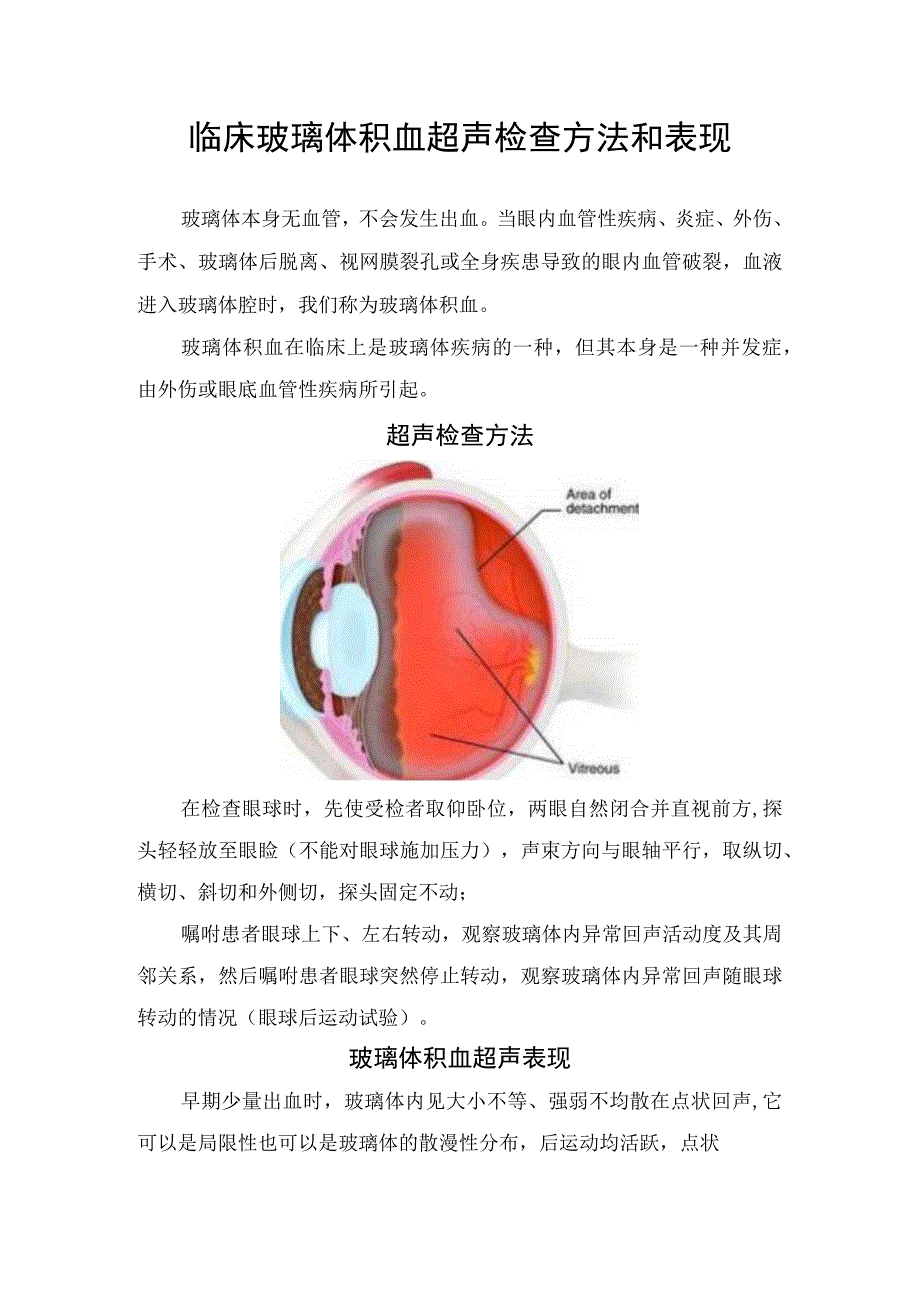 临床玻璃体积血超声检查方法和超生表现.docx_第1页