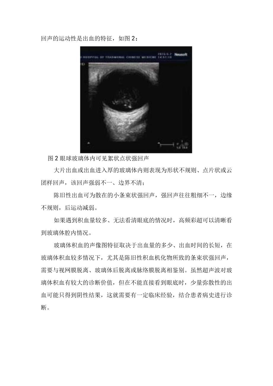 临床玻璃体积血超声检查方法和超生表现.docx_第2页