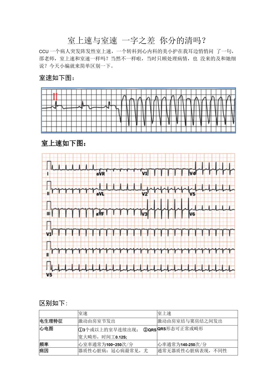 室上速与室速 虽一字之差 你分的清吗？.docx_第1页