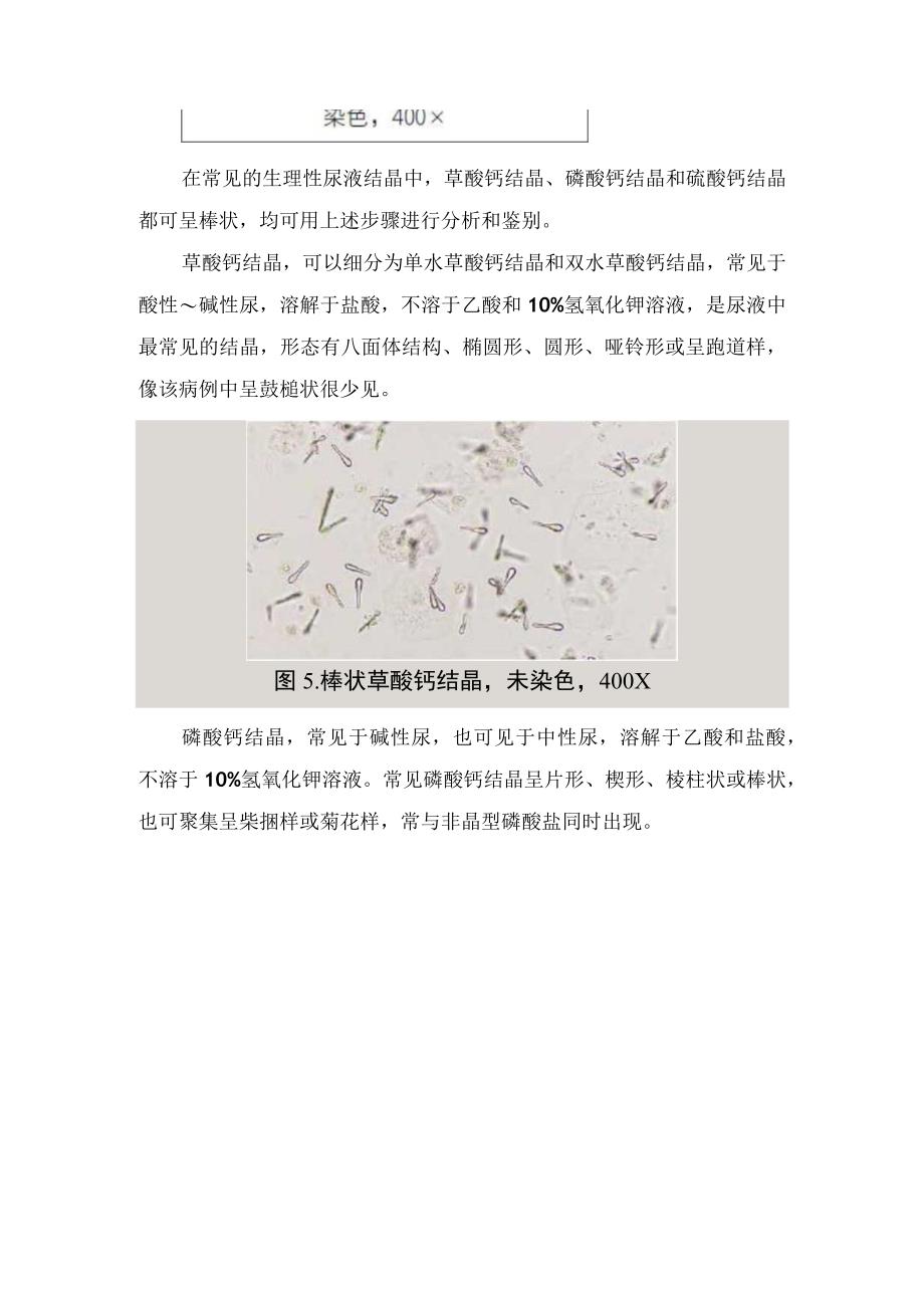 尿液特殊形态草酸钙结晶分析和鉴别流程.docx_第3页