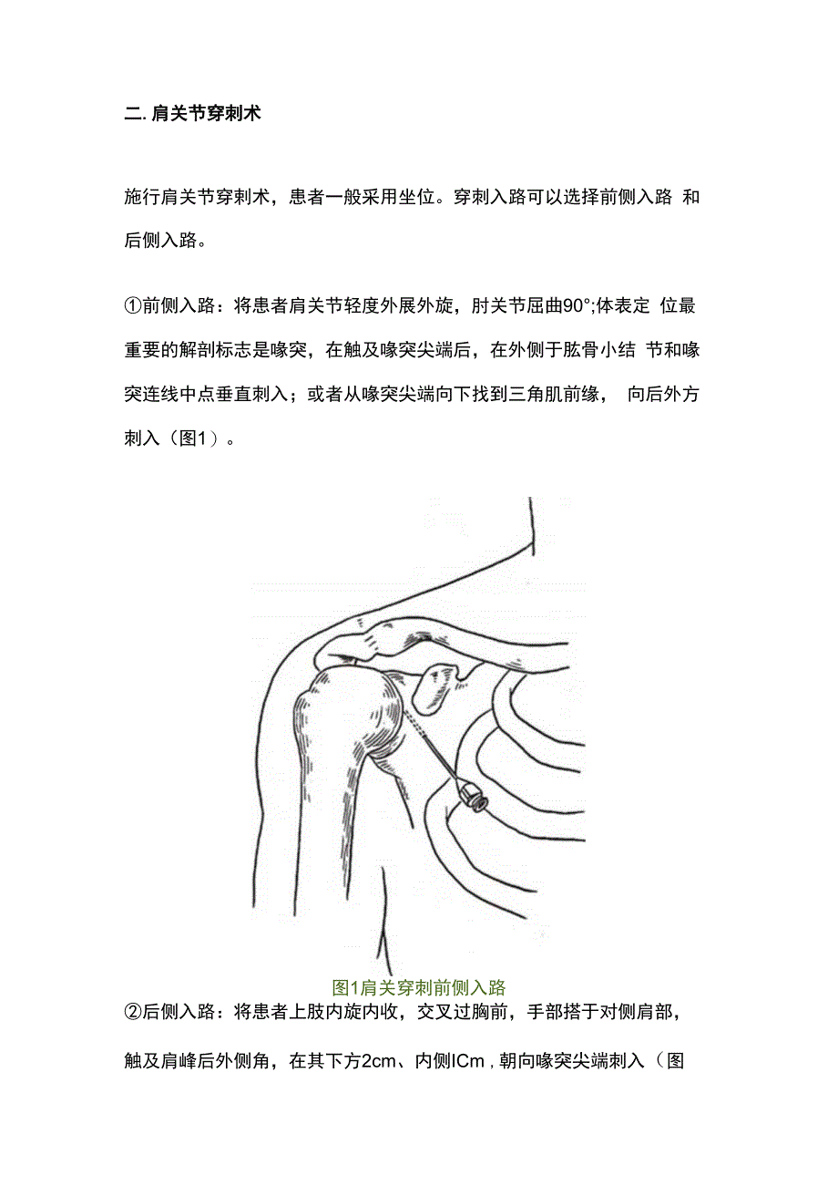 最新：各关节穿剌术的技巧及注意事项.docx_第2页