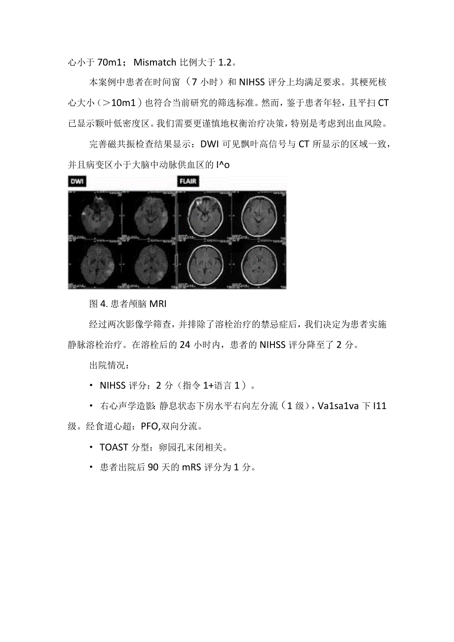 临床醒后卒中静脉溶栓治疗病例分享及要点总结.docx_第3页