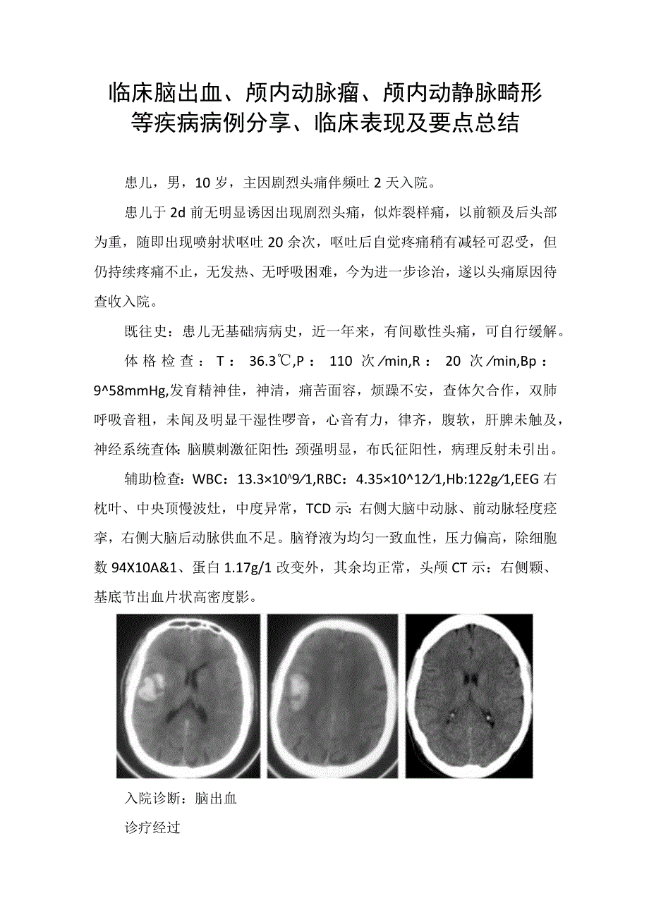 临床脑出血颅内动脉瘤颅内动静脉畸形等疾病病例分享临床表现及要点总结.docx_第1页