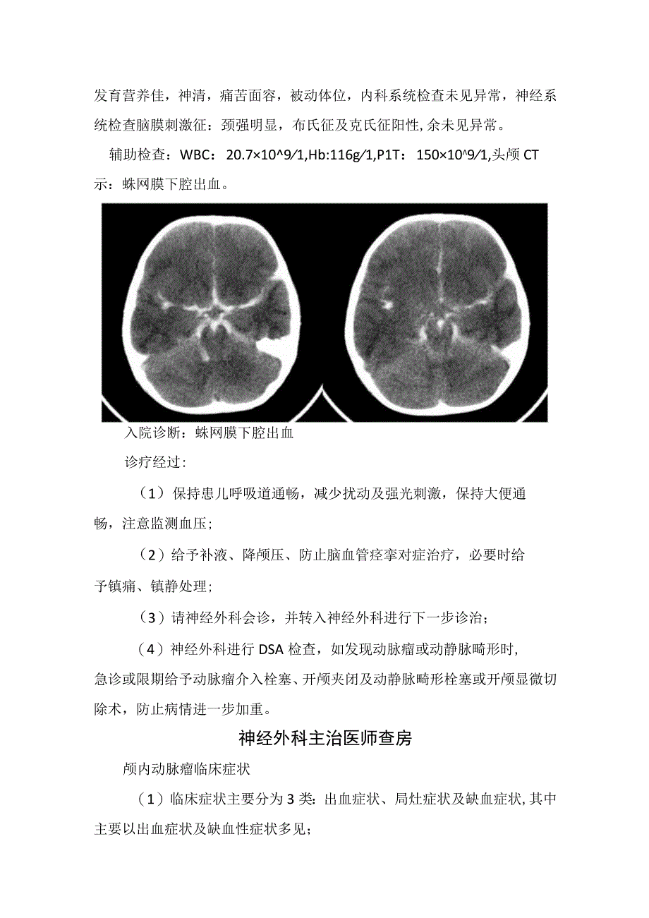 临床脑出血颅内动脉瘤颅内动静脉畸形等疾病病例分享临床表现及要点总结.docx_第3页