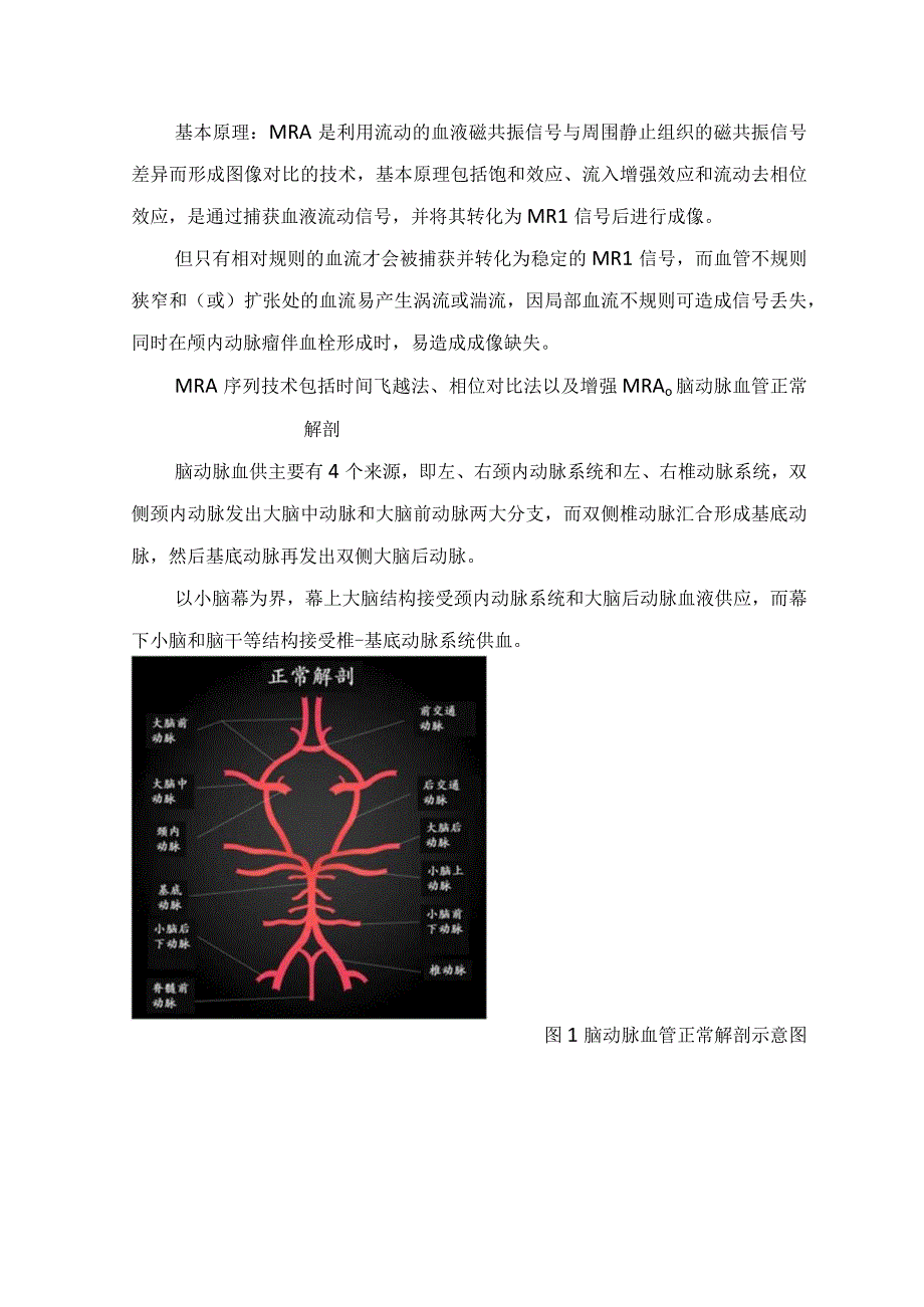 临床头颅MRA常用血管成像对比磁共振血管成像脑动脉血管正常解剖MRA阅片颅脑血管常见变异MRA表现头颅MRA诊断疾病举例及局限性.docx_第2页