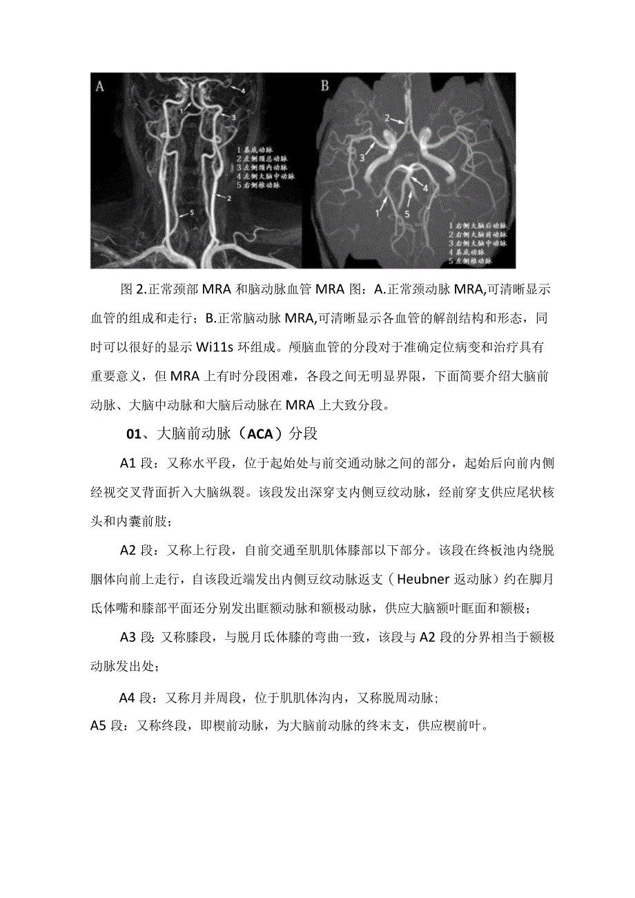 临床头颅MRA常用血管成像对比磁共振血管成像脑动脉血管正常解剖MRA阅片颅脑血管常见变异MRA表现头颅MRA诊断疾病举例及局限性.docx_第3页