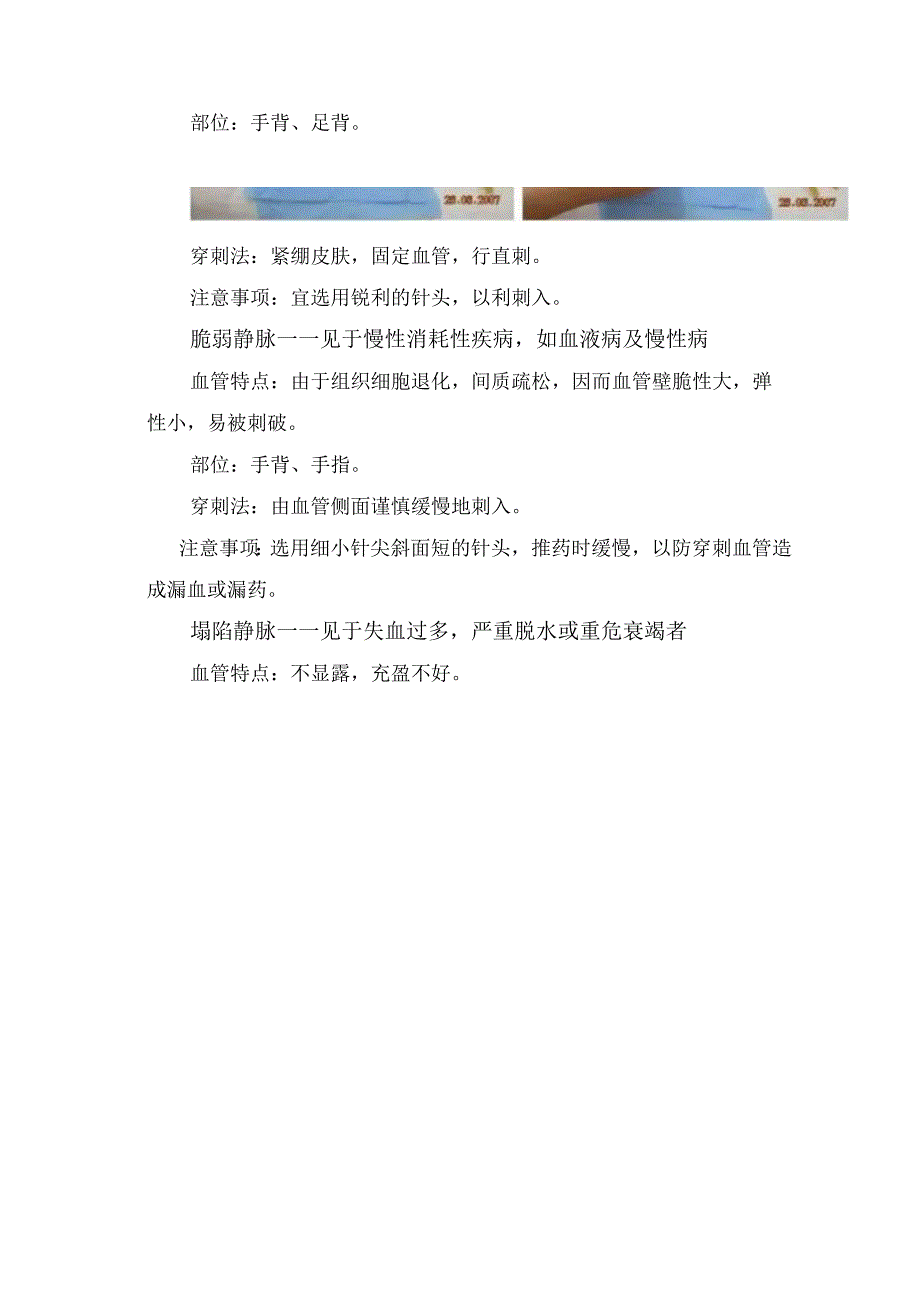 临床普通静脉滑动静脉硬化血管脆弱静脉塌陷静脉水肿静脉隐形充盈静脉小儿静脉等人群血管特点静脉穿刺部位穿刺方法及穿.docx_第2页