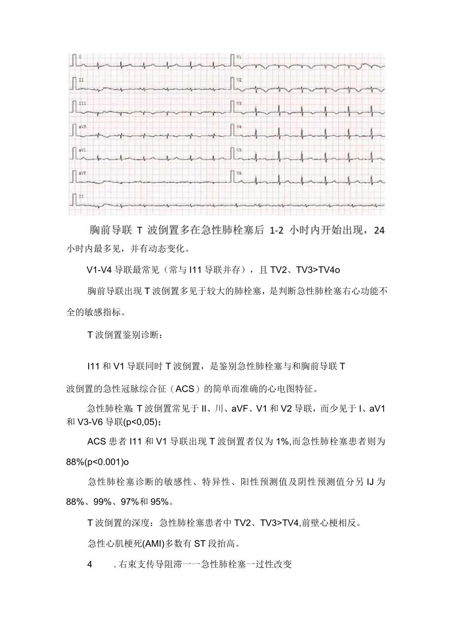 临床急性肺栓塞病理生理12导联体表心电图改变心电图评分及要点总结.docx_第3页