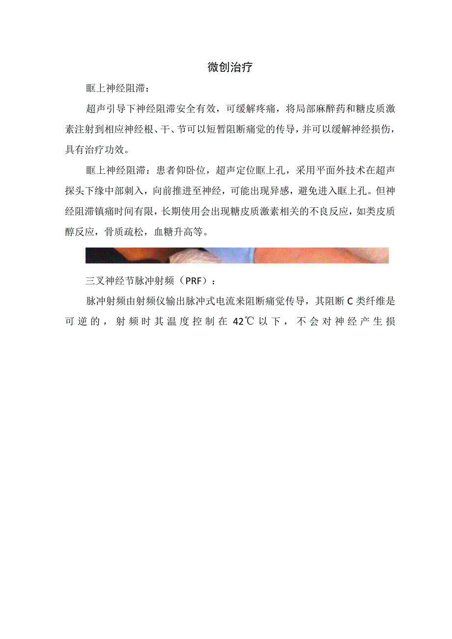 临床带状疱疹后眼神经痛治疗和预防.docx_第2页