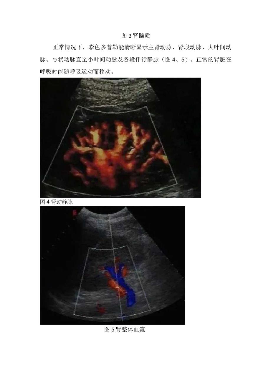泌尿系统主要部位及肾脏输尿管膀胱前列腺正常泌尿系超声数值及表现.docx_第3页