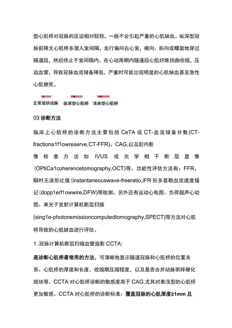 2024心肌桥的诊断与治疗.docx_第2页