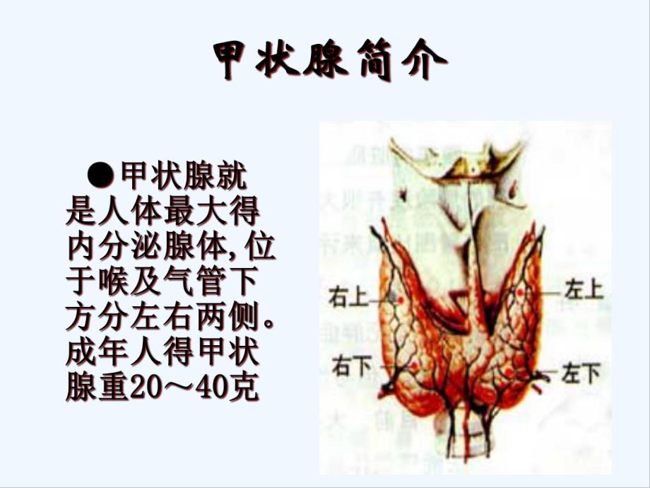 单纯性甲状腺肿.pptx_第2页