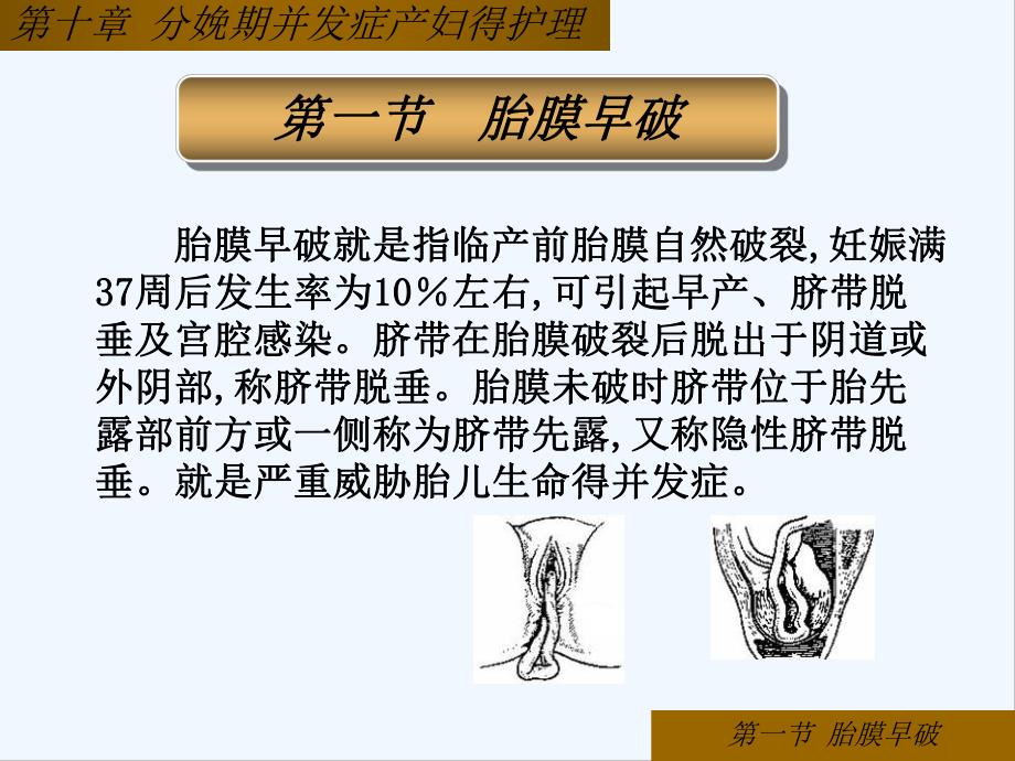 第十章分娩期并发症产妇的护理-PPT.pptx_第3页