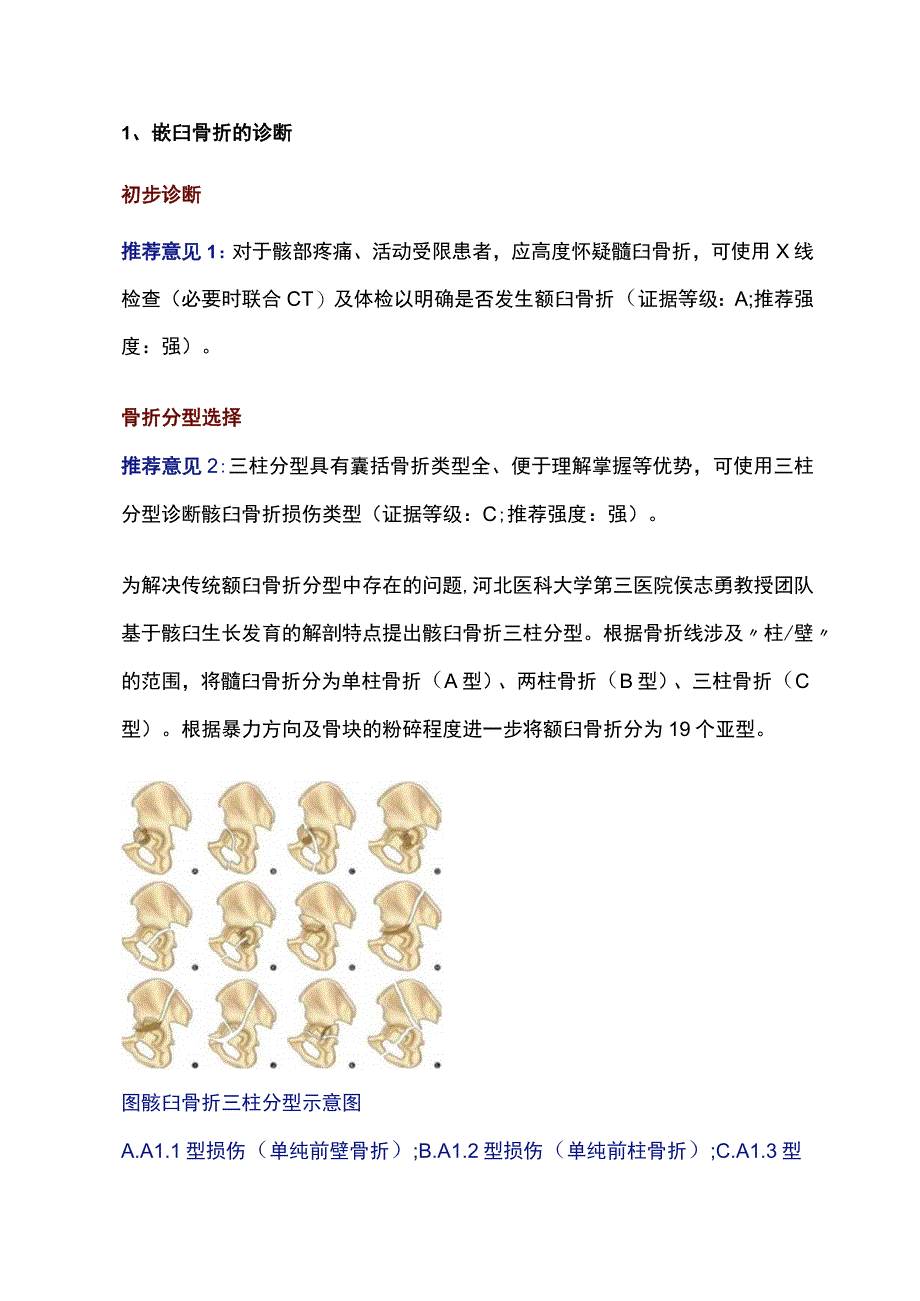 基于三柱分型的髋臼骨折精准诊疗专家共识（2023版）推荐意见.docx_第2页