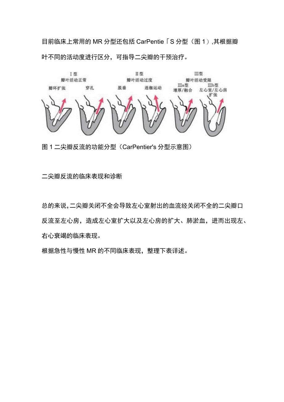 2024急性和慢性二尖瓣反流的临床表现差异.docx_第3页