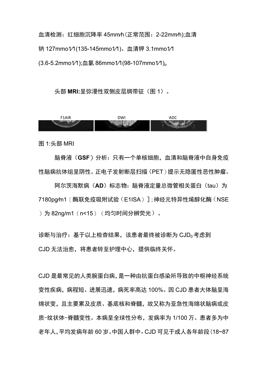 2024致命的神经退行性疾病（附表）.docx_第2页