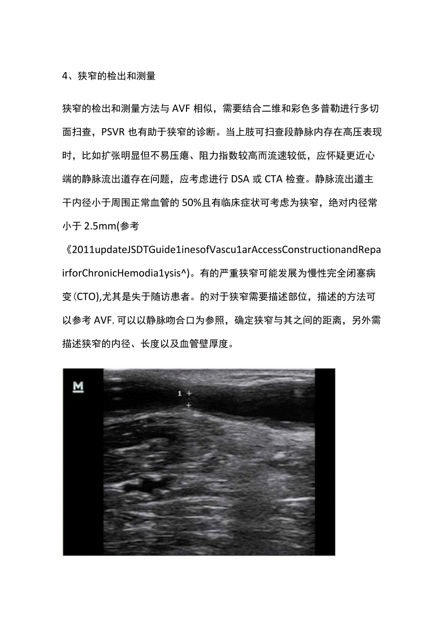 人工血管动静脉内瘘的超声评估.docx_第3页