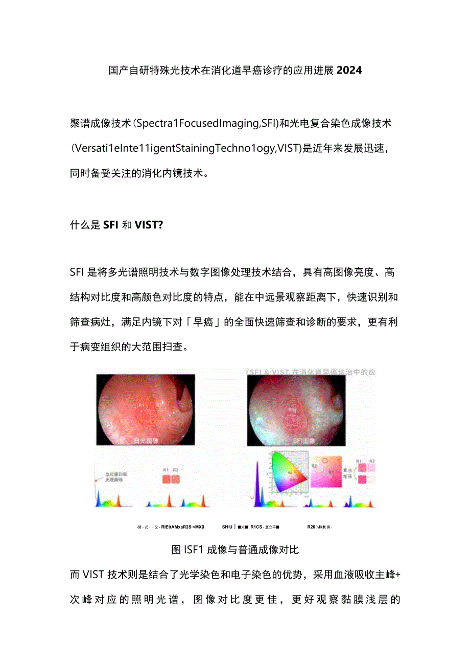 国产自研特殊光技术在消化道早癌诊疗的应用进展2024.docx_第1页