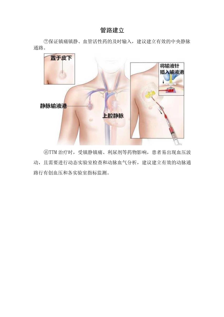 温度范围、启动时机、体温检测、镇痛镇静管理、营养支持、病情监测、神经功能预后评估等ICU脑损伤患者目标体温管理要点.docx_第2页