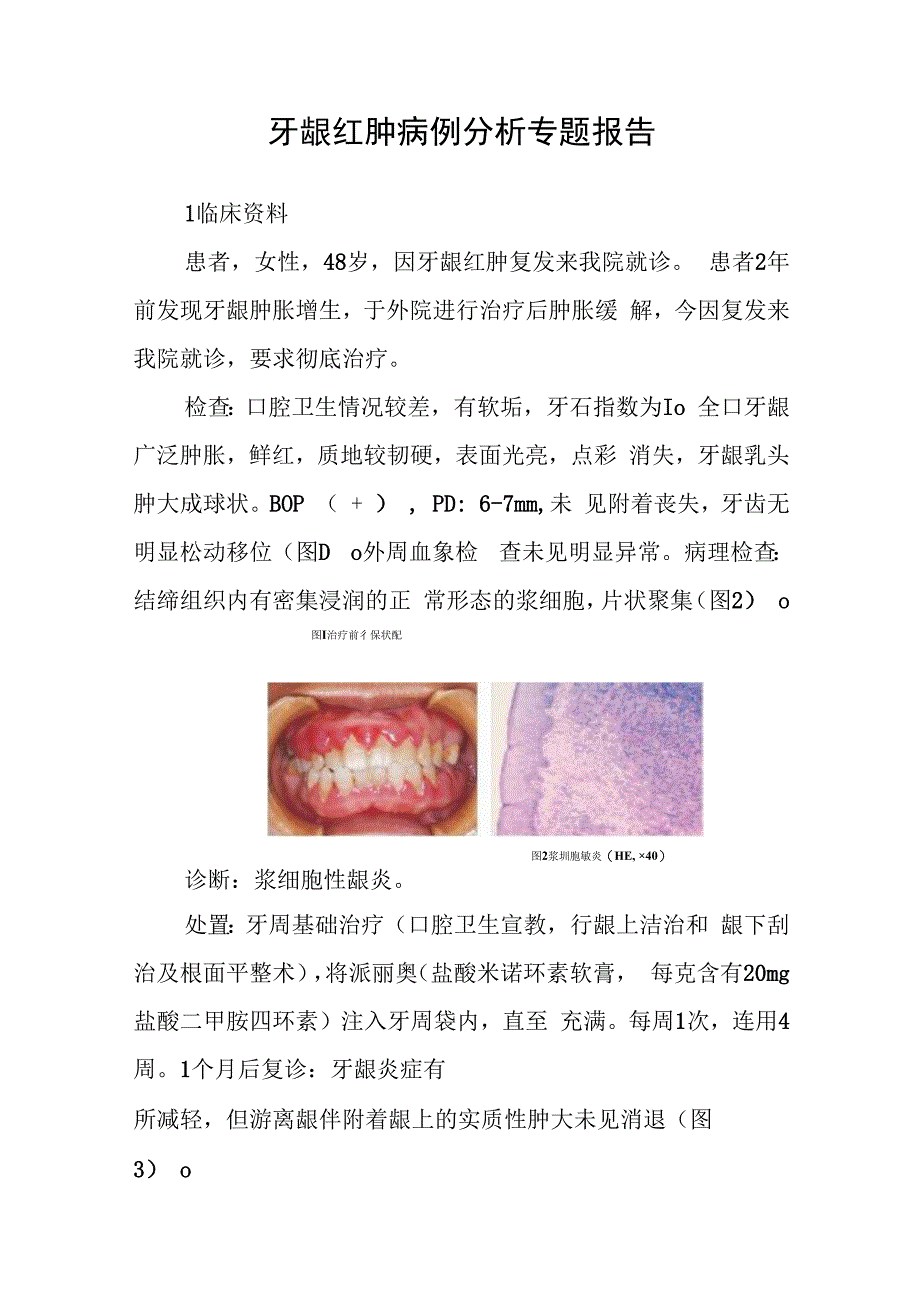 口腔科医师晋升副主任医师病例分析专题报告（牙龈红肿病）.docx_第2页