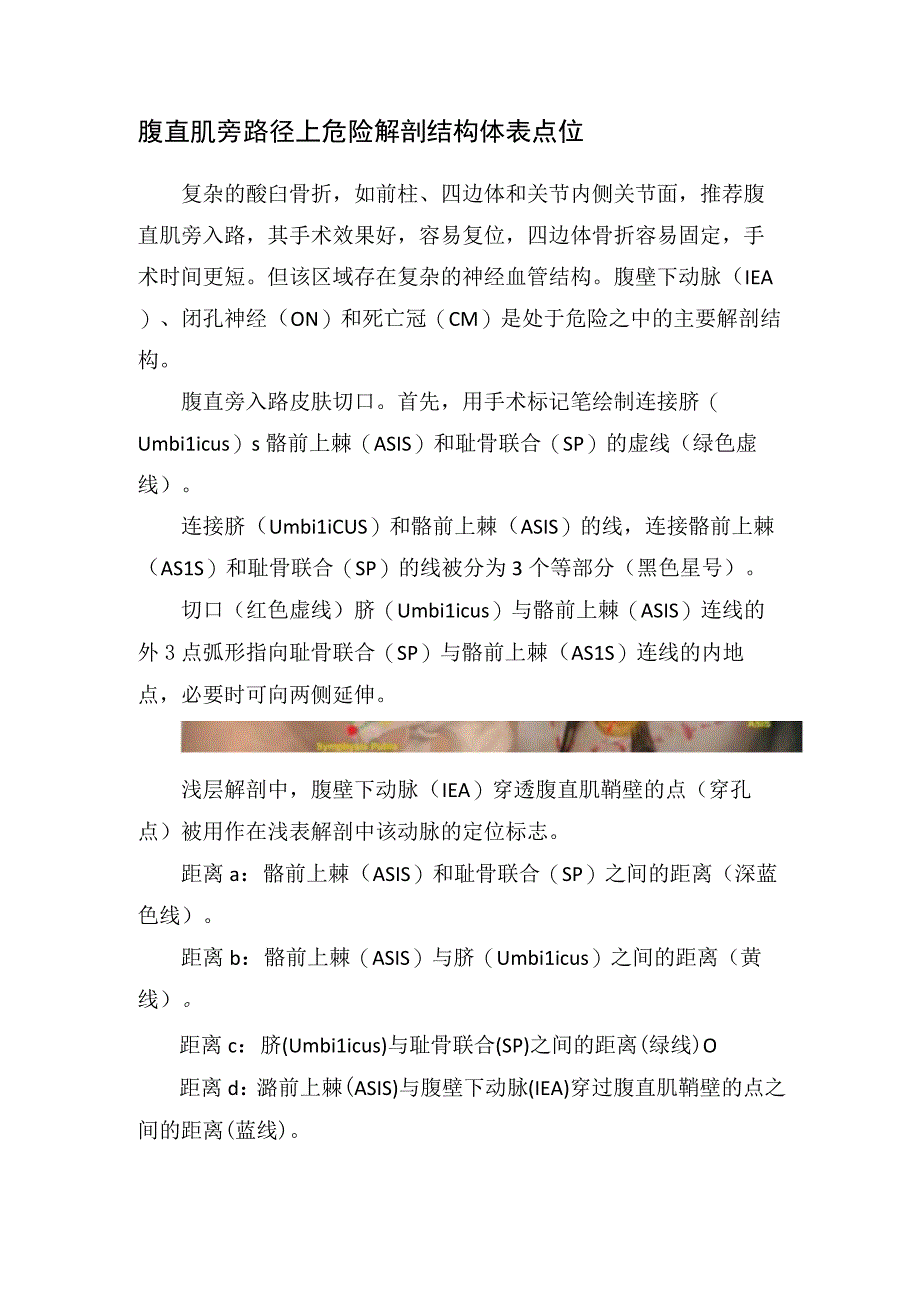 腹直肌旁路径上危险解剖结构体表点位.docx_第1页