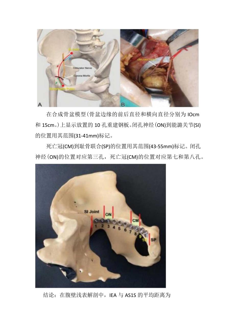 腹直肌旁路径上危险解剖结构体表点位.docx_第3页