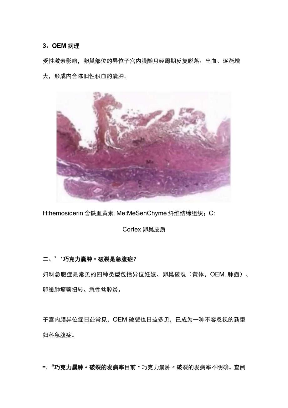 2023巧克力囊肿破裂的诊治.docx_第3页