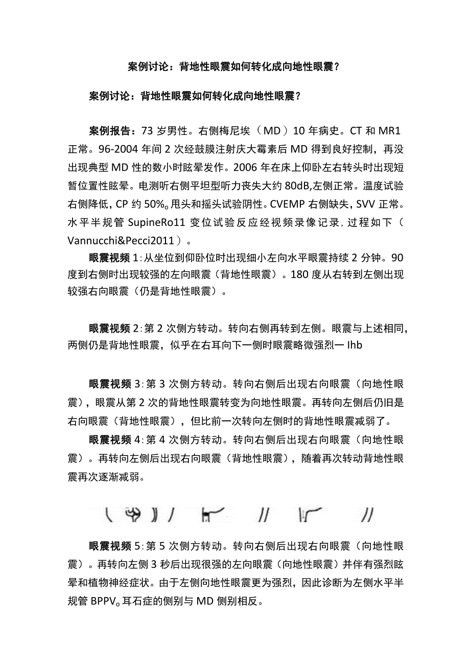 案例讨论：背地性眼震如何转化成向地性眼震？.docx_第1页