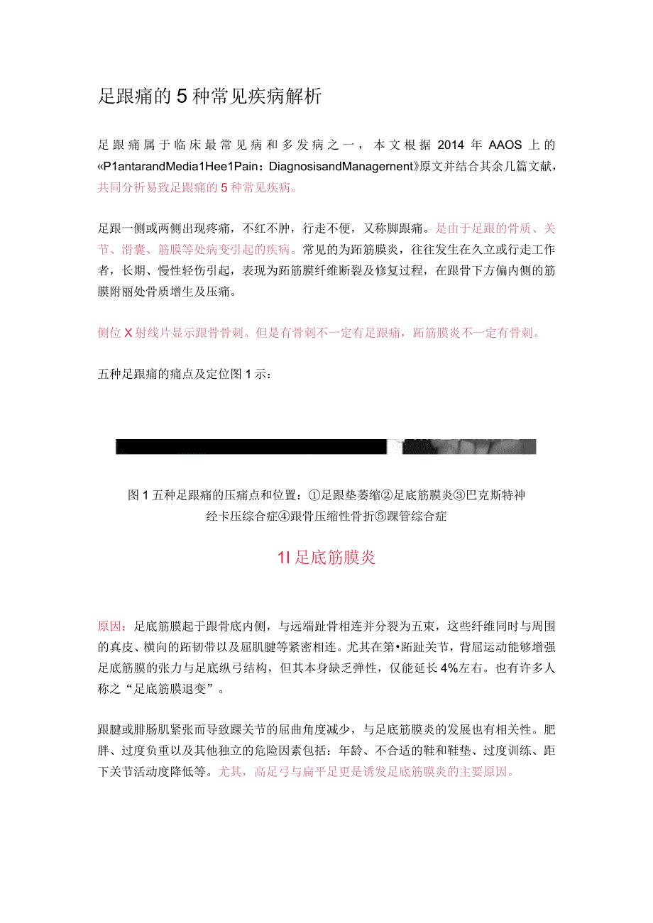 足跟痛的5种常见疾病解析针刀医学培训中心.docx_第1页