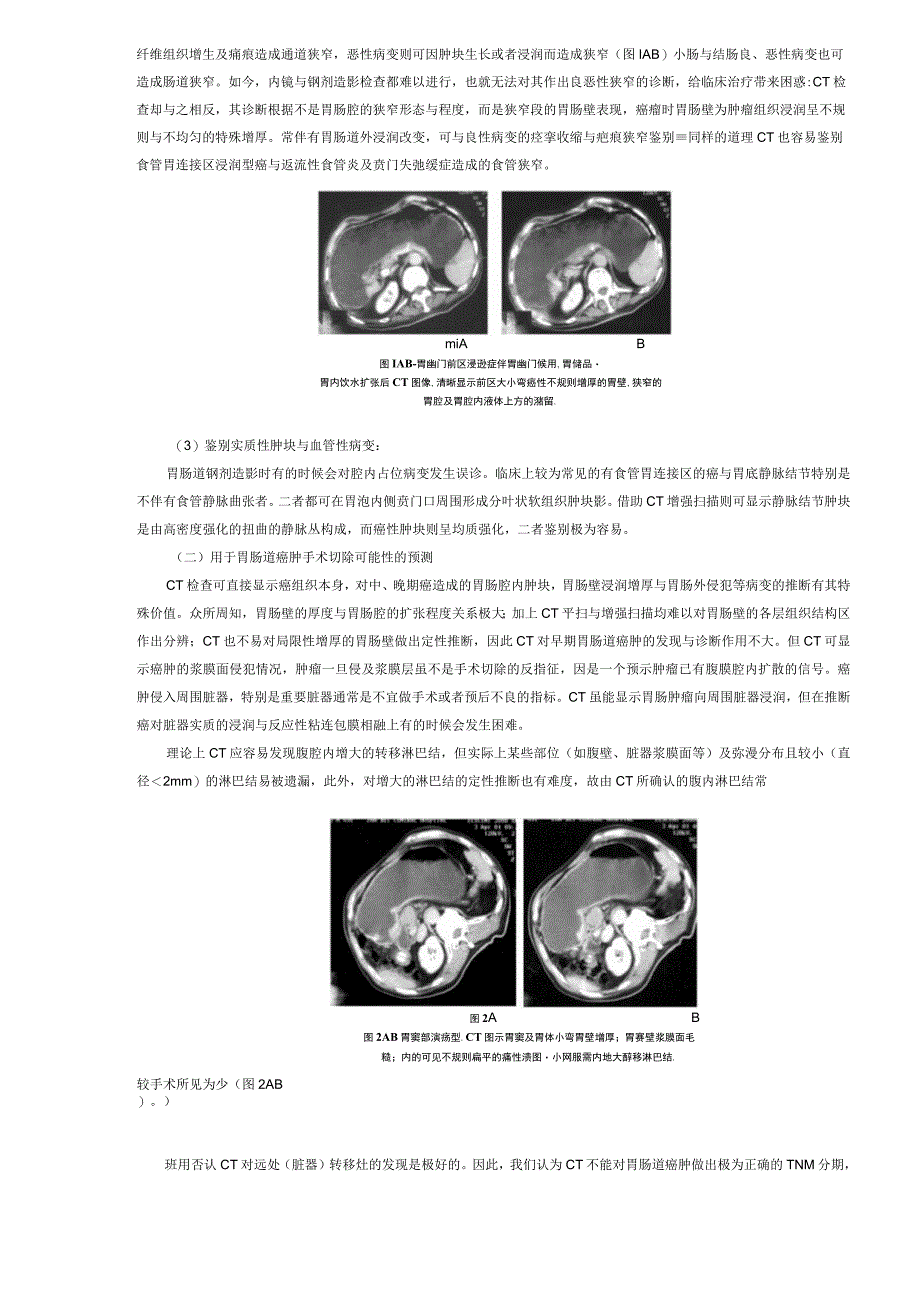 CT在胃肠道疾患诊断中的应用.docx_第2页