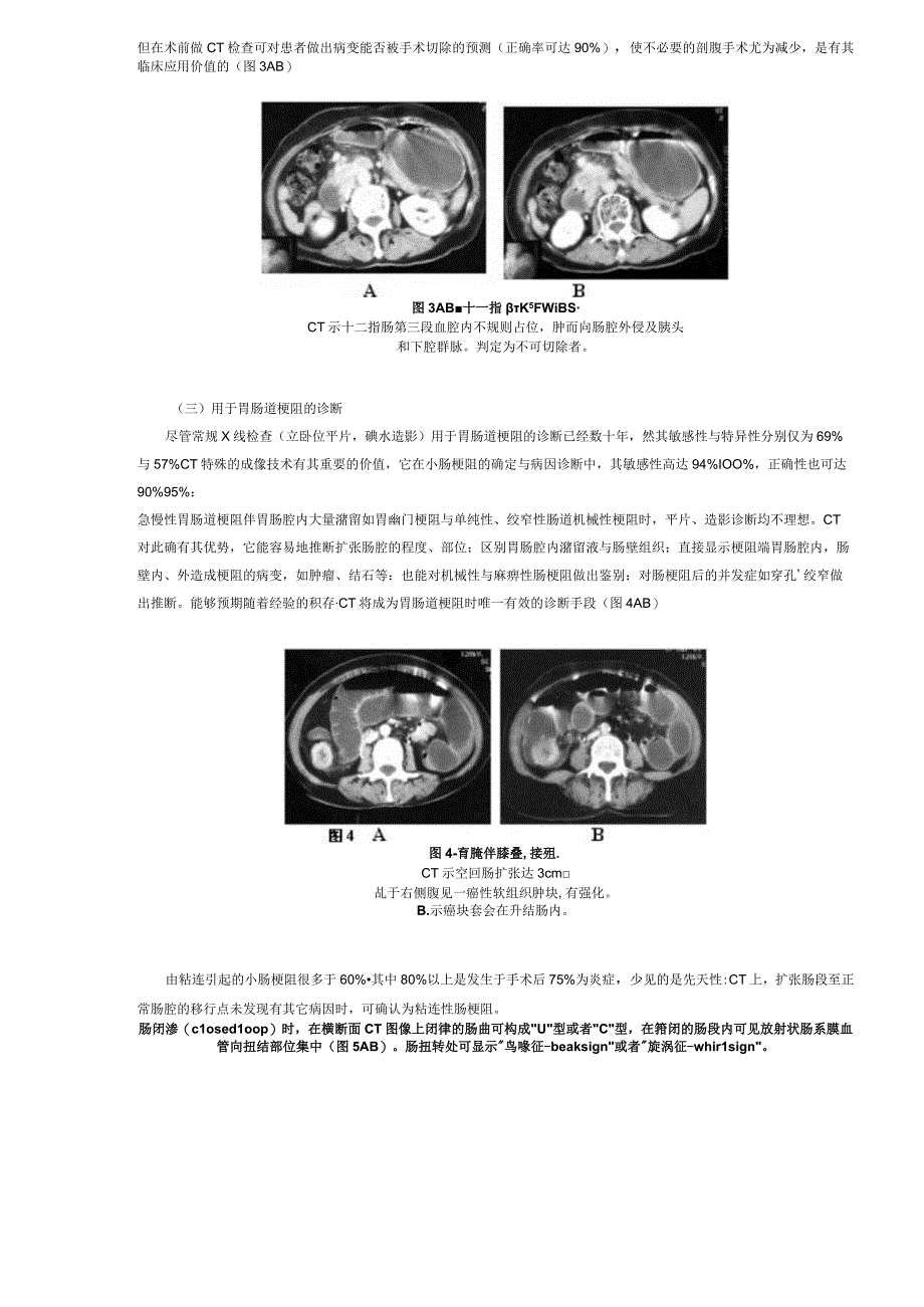 CT在胃肠道疾患诊断中的应用.docx_第3页