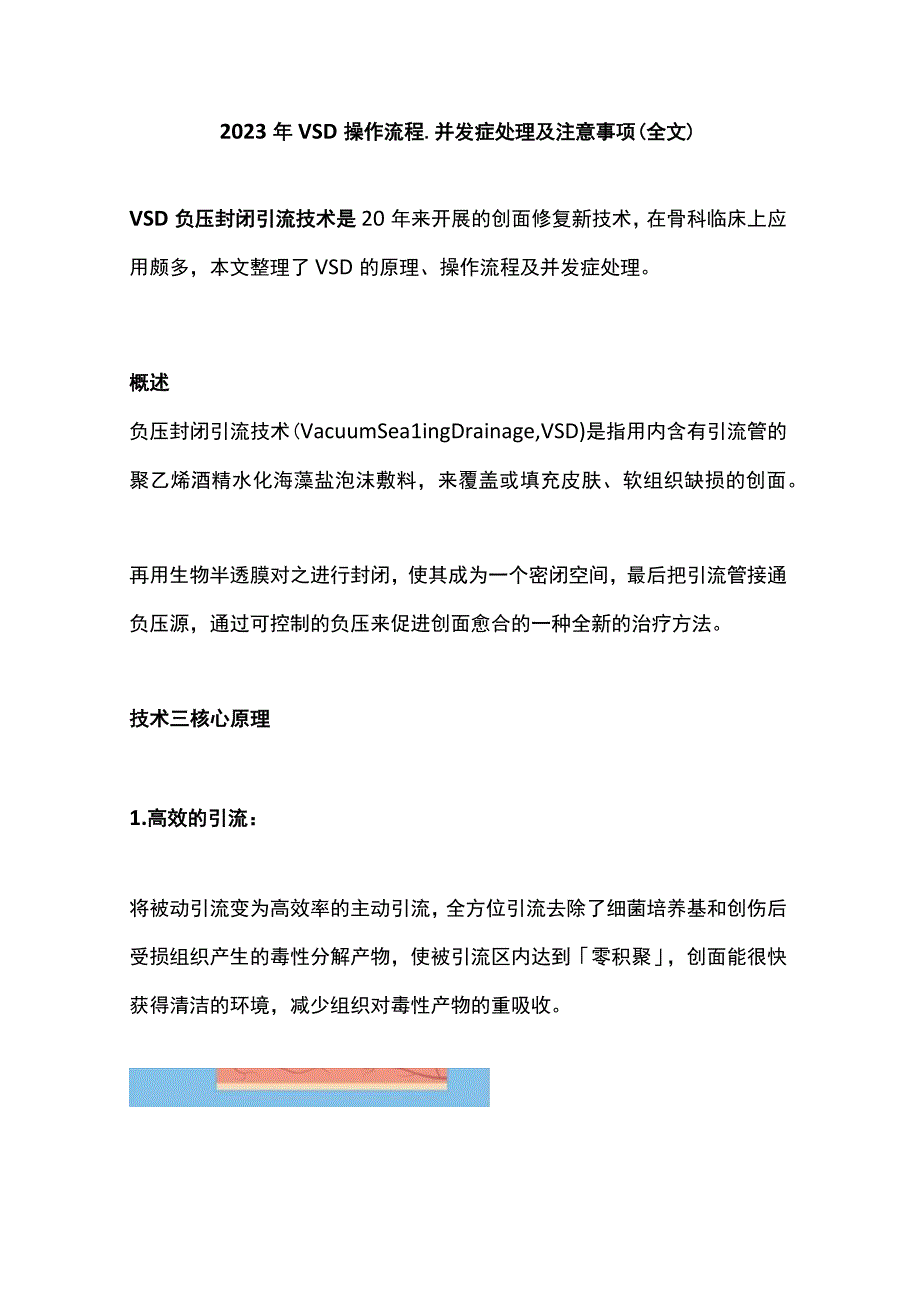 2022年VSD 操作流程、并发症处理及注意事项（全文）.docx_第1页