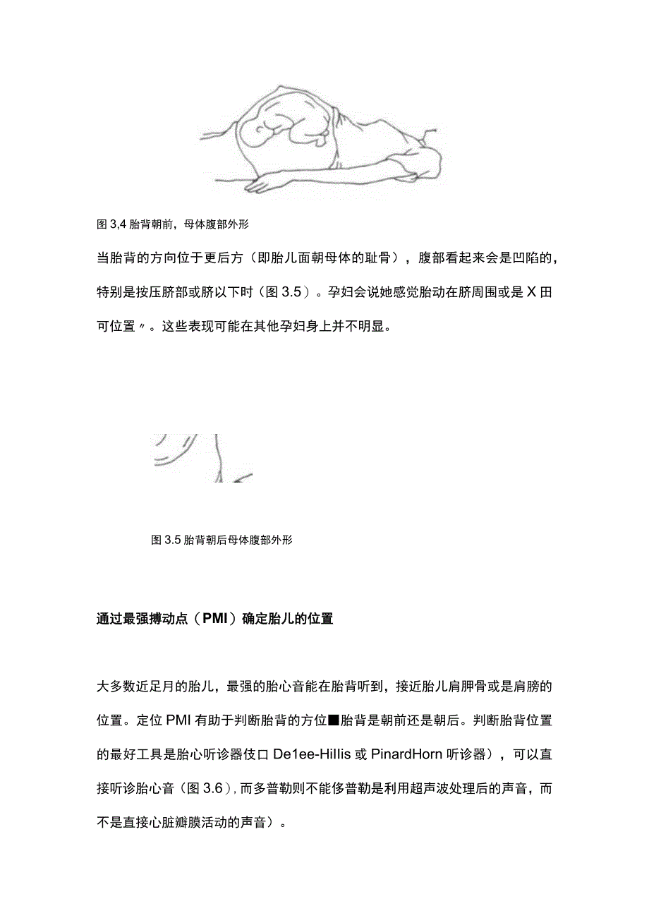 最新：判断胎方位和评估胎儿位置的四步触诊法步骤与技巧（全文）.docx_第3页