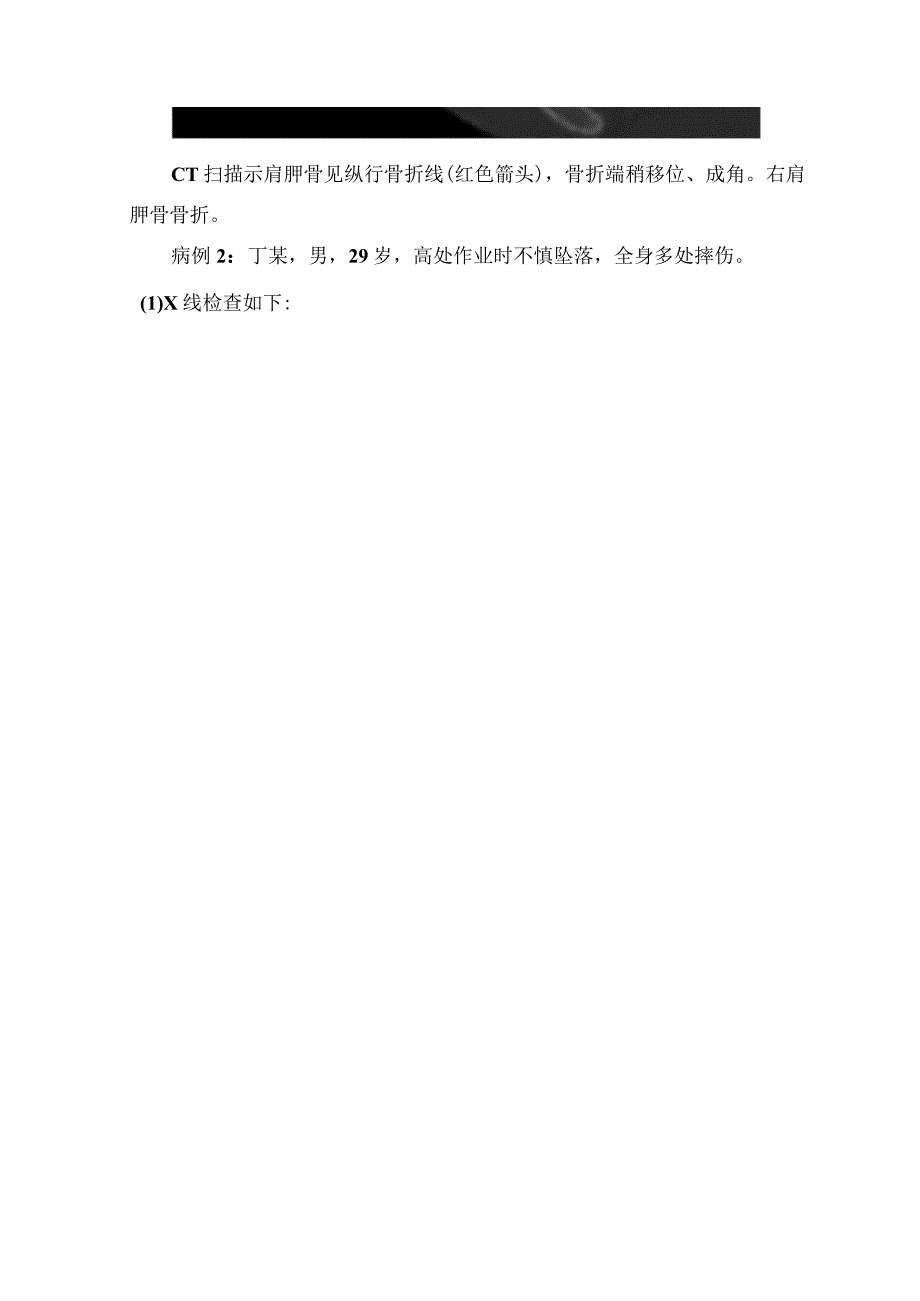 临床肩部外伤结构组成、影像学CT表现特征及病例分享.docx_第3页