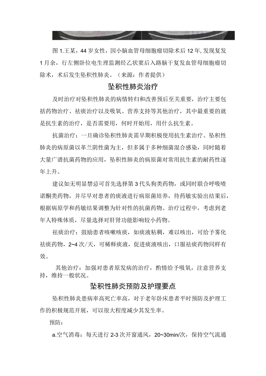 临床坠积性肺炎发病机制、影像学表现、预防措施及护理要点.docx_第2页