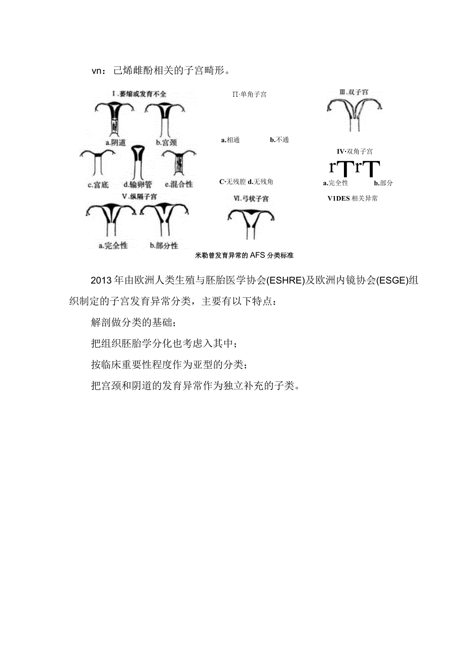 临床女性生殖器发育异常分类、超声表现和分型.docx_第2页