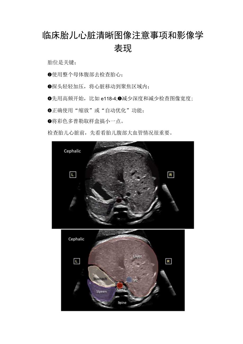 临床胎儿心脏清晰图像注意事项和影像学表现.docx_第1页