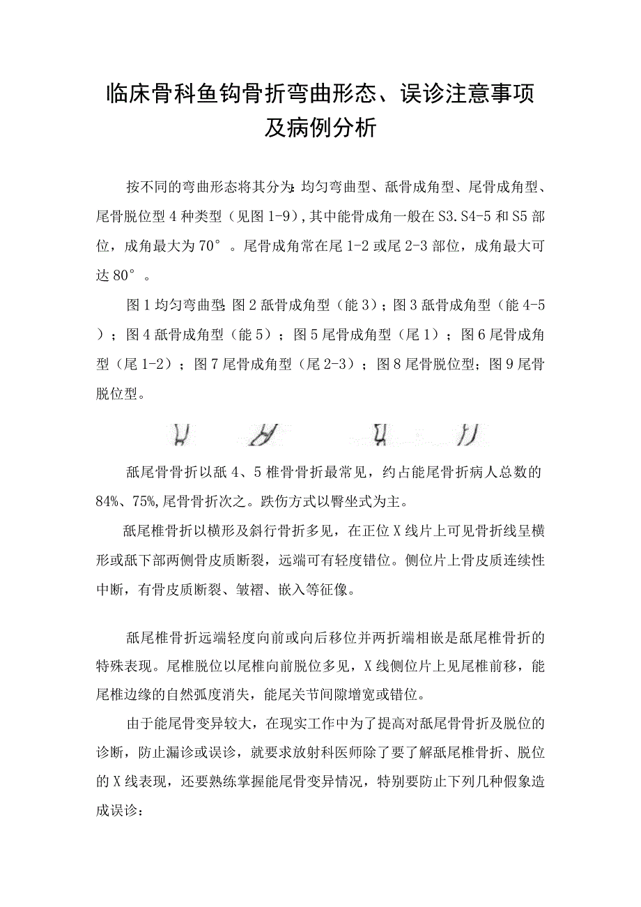 临床骨科鱼钩骨折弯曲形态、误诊注意事项及病例分析.docx_第1页