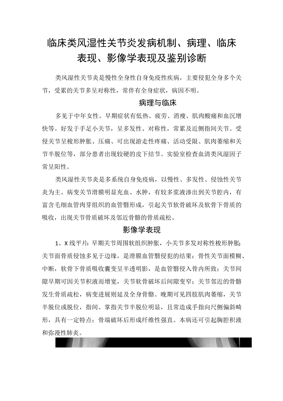 临床类风湿性关节炎发病机制、病理、临床表现、影像学表现及鉴别诊断.docx_第1页