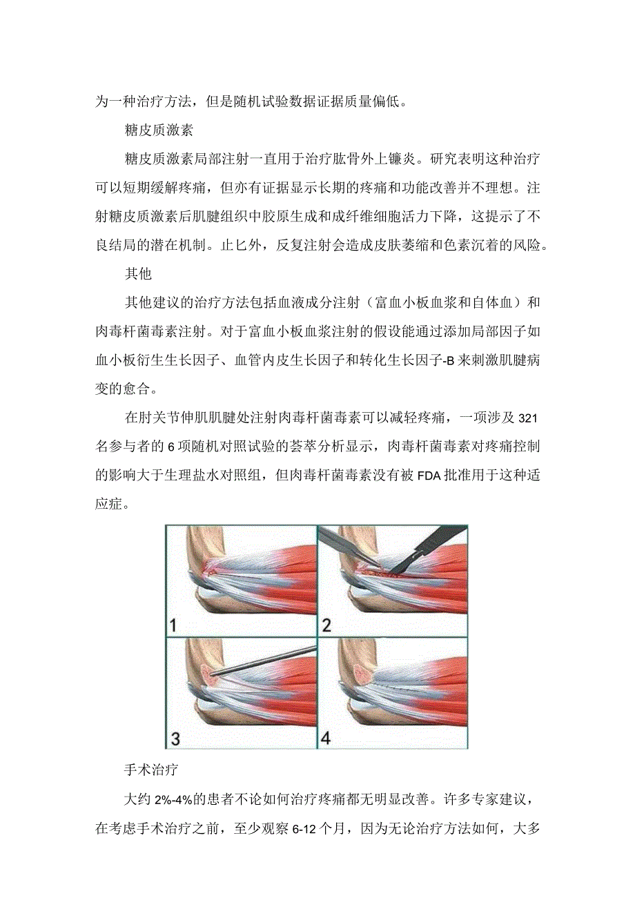 临床肱骨外上髁炎发病机制、临床要点及临床治疗.docx_第3页