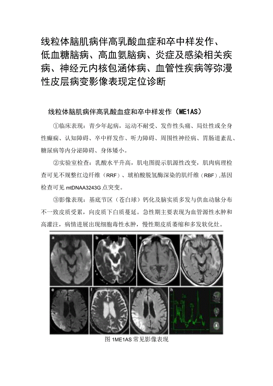 线粒体脑肌病伴高乳酸血症和卒中样发作、低血糖脑病、高血氨脑病、炎症及感染相关疾病、神经元内核包涵体病、血管性疾病等弥漫性皮层病变.docx_第1页