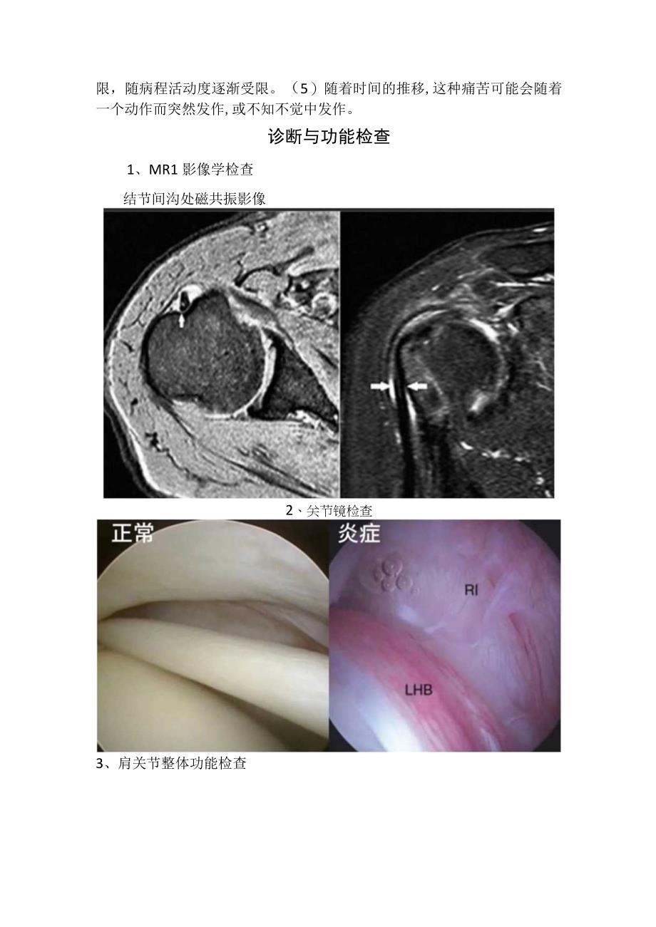 肱二头肌功能解剖、二头肌长头肌腱炎临床症状、诊断与功能检查及治疗方案与建议.docx_第3页