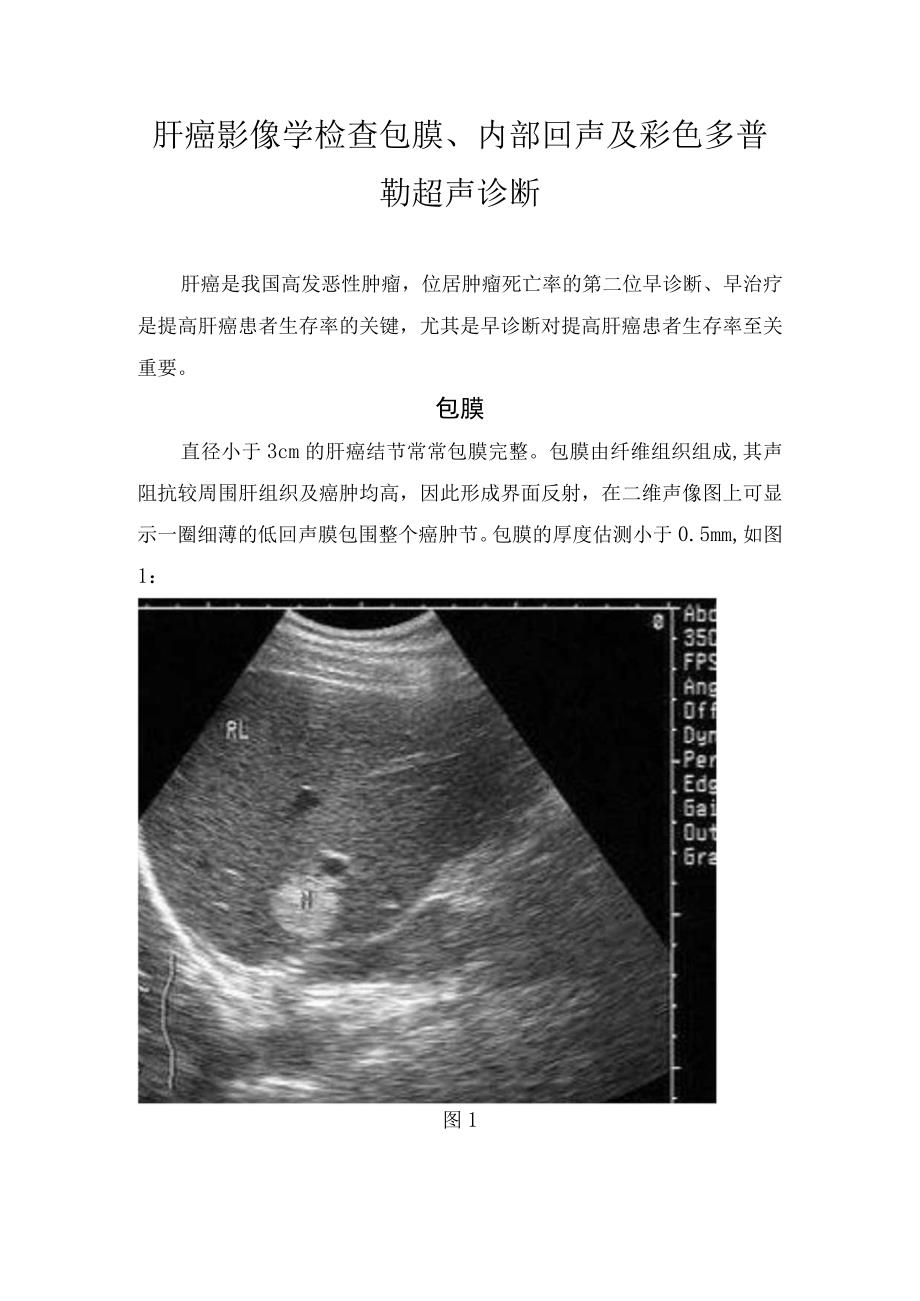 肝癌影像学检查包膜、内部回声及彩色多普勒超声诊断.docx_第1页