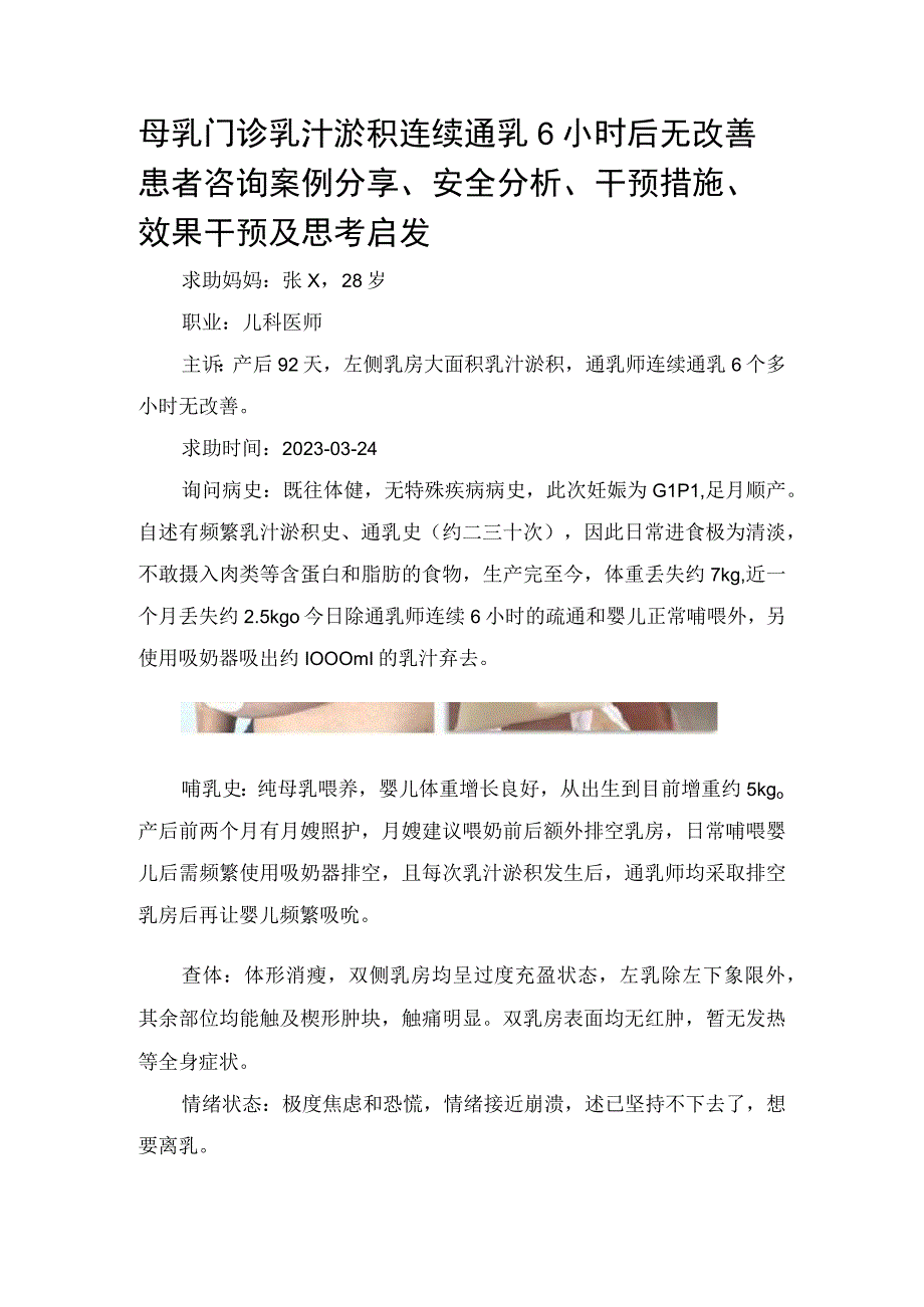 母乳门诊乳汁淤积连续通乳6小时后无改善患者咨询案例分享安全分析干预措施效果干预及思考启发.docx_第1页