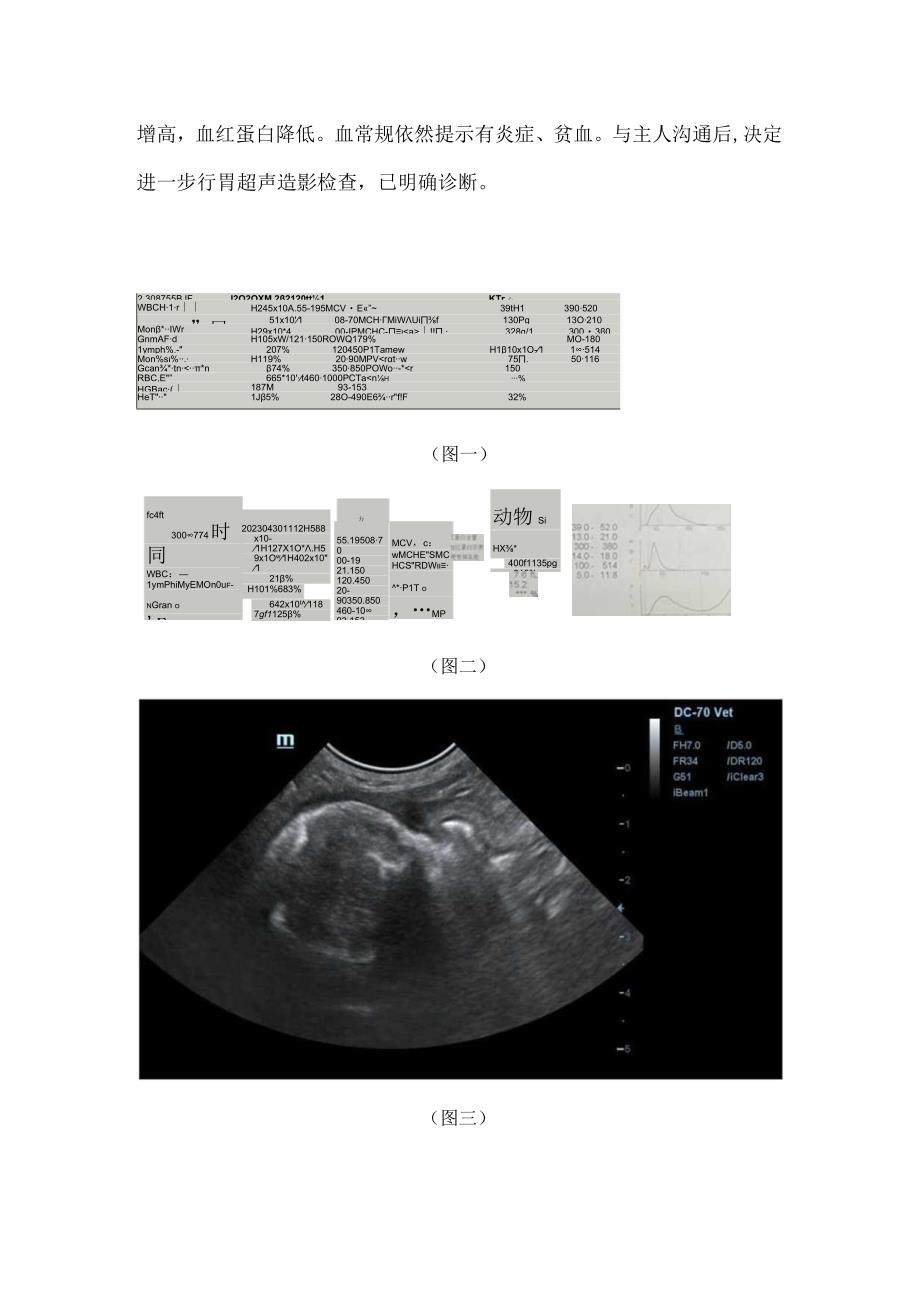 胃肠超声造影在胃肠占位中的应用.docx_第2页