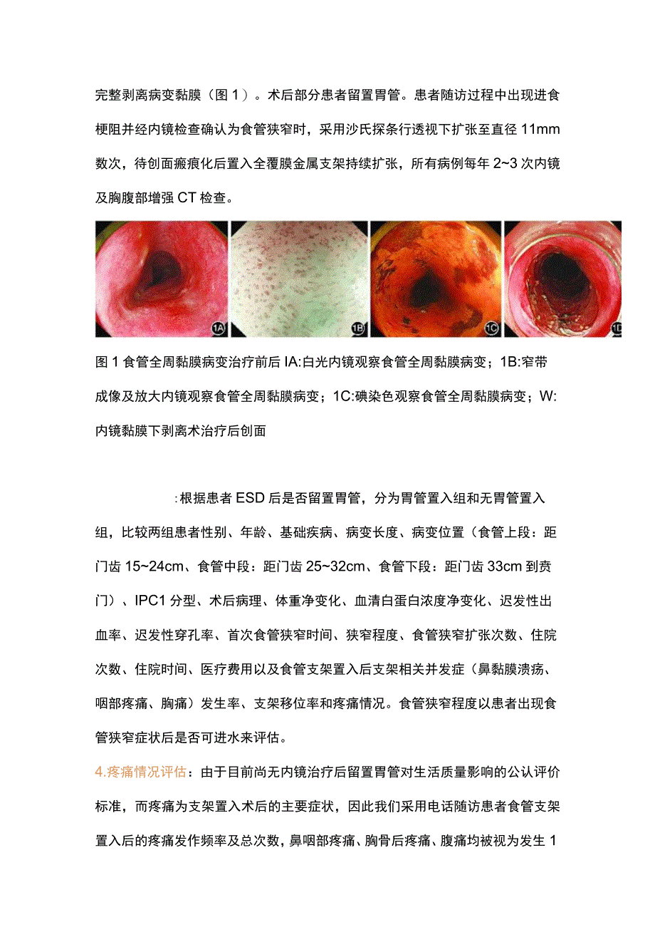 2023食管全周浅表癌内镜黏膜下剥离术后长期保留胃管对食管狭窄的预防及治疗作用.docx_第3页