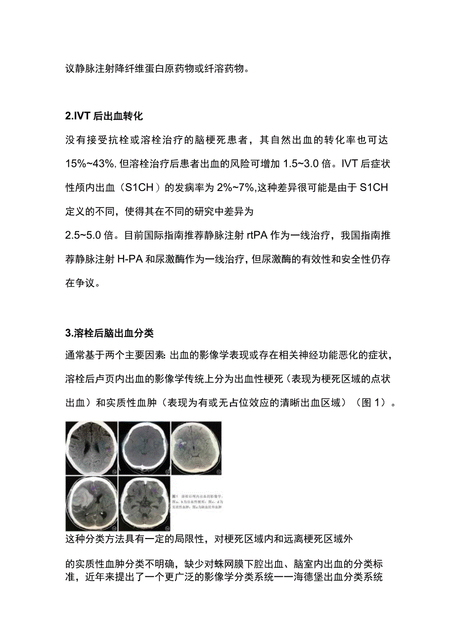 2023急性缺血性脑卒中静脉溶栓后出血转化危险因素的研究进展.docx_第2页