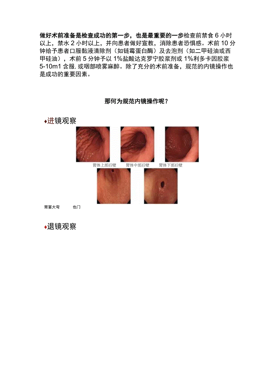 2023早期胃癌的规范化内镜诊断.docx_第3页